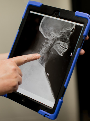 Urgent Care Bellevue TN X-Ray Display